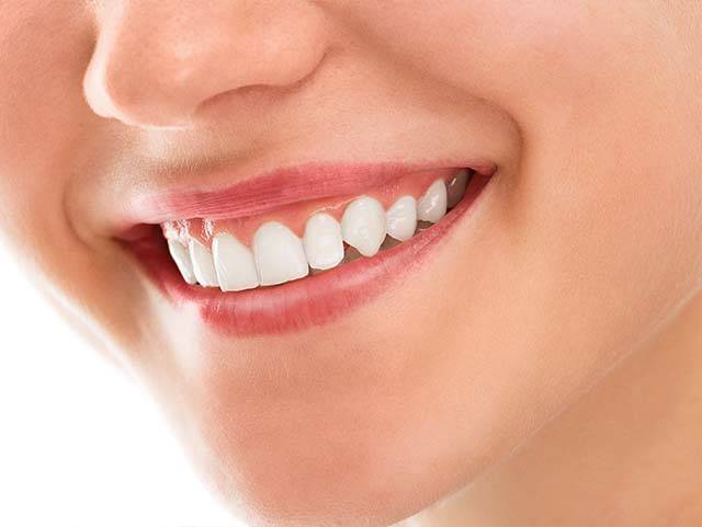 hollywood smile abu dhabi