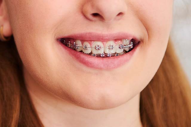 best dental implants in abu dhabi