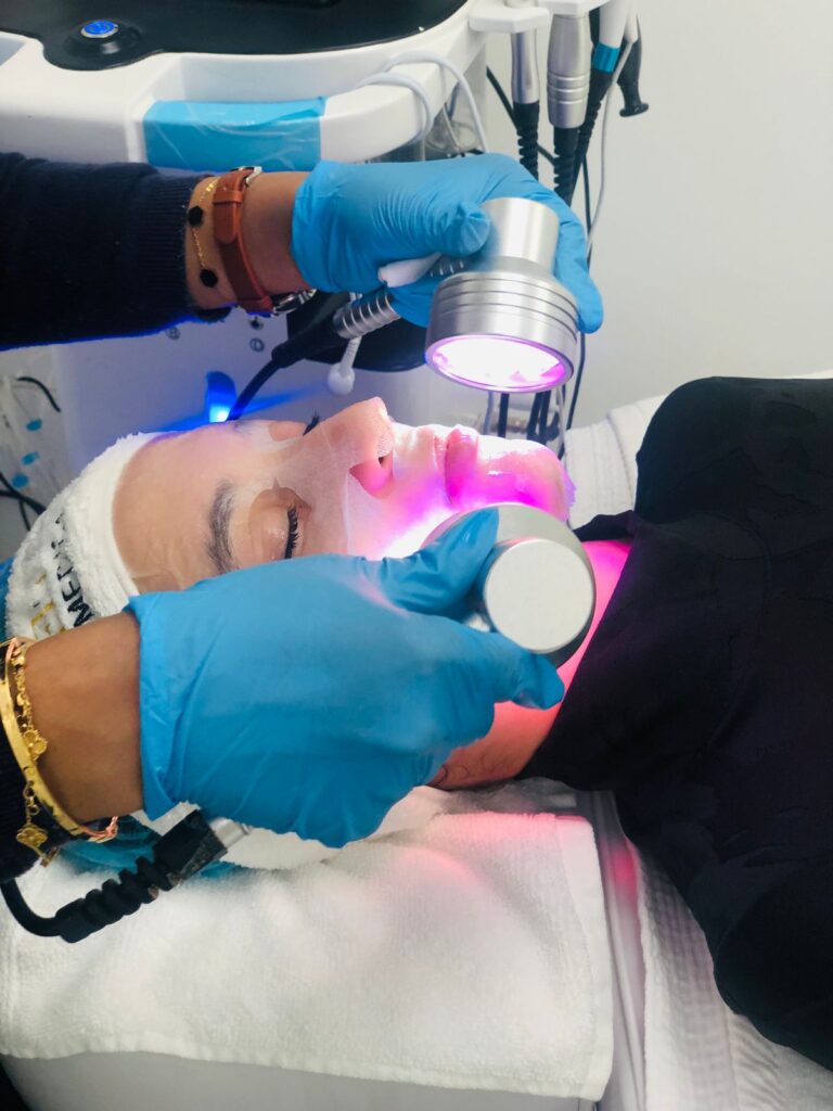 laser treatment for face