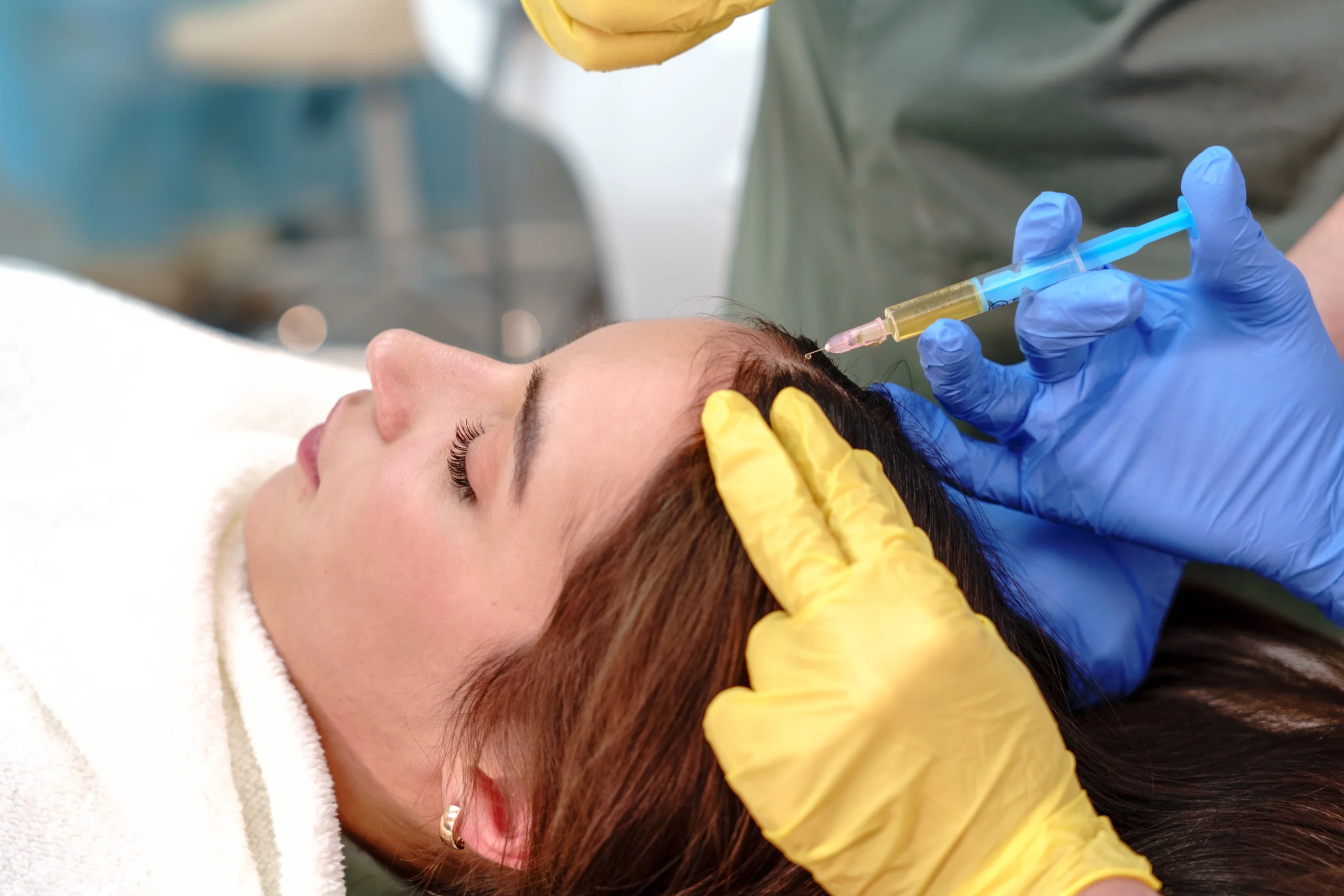 Hair PRP treatment in Abu Dhabi